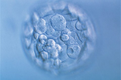 http://jiaxing.quanwangkm.com/post/190.html|嘉兴人工试管
